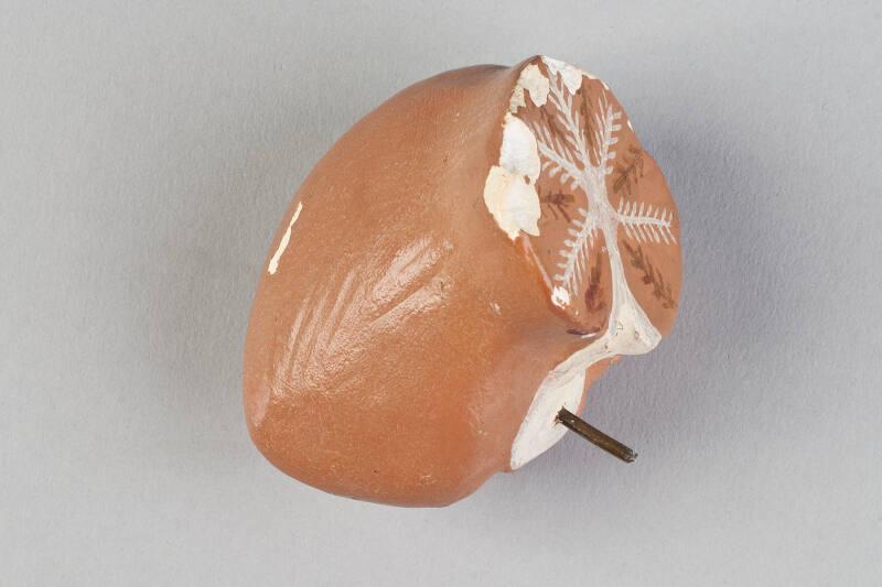 Section of Cerebellum of Human Brain