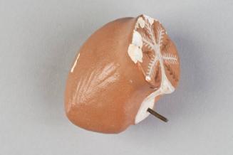 Section of Cerebellum of Human Brain